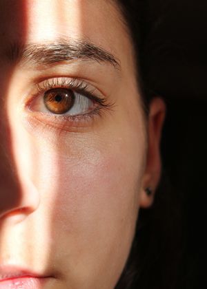 Woman exposed to sunlight from eclipse